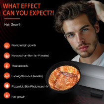 Laser Hair Growth Cap - FDA Cleared Red Light Therapy for Men & Women