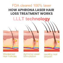 FDA-Cleared Laser Hair Growth Cap for Men and Women