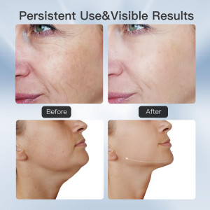 3-in-1 Beauty Massager: LED, Thermal & Vibration for Skin Care