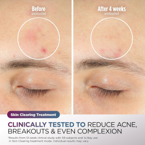 Masque LED Shark CryoGlow : Raffermissant & Éclaircissant