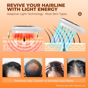 Peigne Laser pour Croissance Cheveux : Thérapie Rouge à Domicile