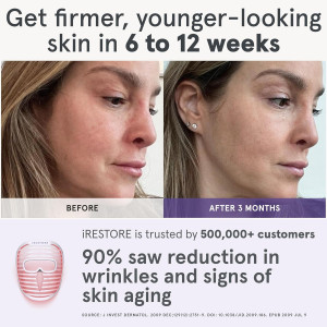 iRestore LED Face Mask: Blue, Infrared & Red Light Therapy for Youthful Skin