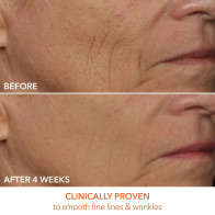 Dr. Dennis Gross DRx SpectraLite FaceWare Pro: LED Mask for Anti-Aging