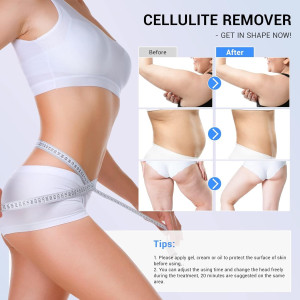 Transform Your Skin: Radio Frequency Cellulite Massager Device