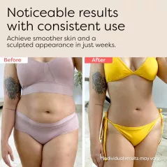3-en-1 Sculptant Corps : Massager Anti-Cellulite et Raffermissant