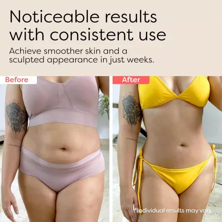 3-en-1 Sculptant Corps : Massager Anti-Cellulite et Raffermissant