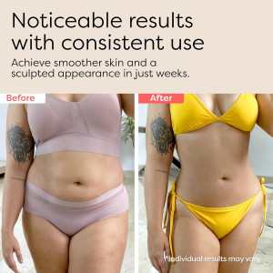 3-in-1 Body Sculptor: Anti-Cellulite Massager for Stomach & More