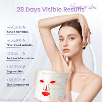 Masque LED Thérapie Rouge : Rajeunissement Peau & Acné