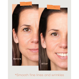 NEWKEY Ultra-Lightweight Cordless Red Light Therapy Mask for Skin