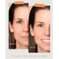 NEWKEY Masque LED Thérapie Rouge & Bleue : Anti-Âge, Anti-Acné, Sans Fil – Soin Visage 10 Minutes