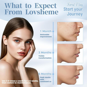 Revitalize Your Skin: Medical-Grade LED Face Mask for Wrinkles & Acne