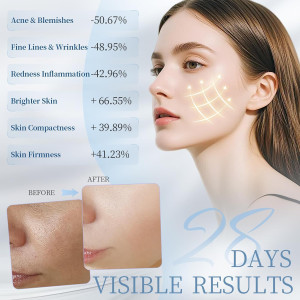 Revitalize Your Skin: Medical-Grade LED Face Mask for Wrinkles & Acne