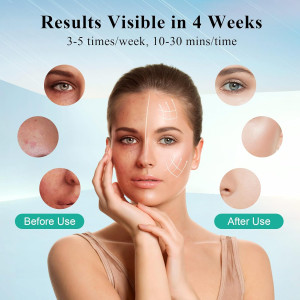 7+1 Colors LED Face Mask — Red light therapy for anti-aging & skincare, portable and rechargeable!