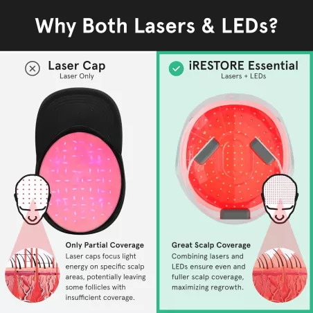 iRestore Essential : Casque Laser Anti-Chute de Cheveux - Croissance Prouvée, Résultats Visibles!