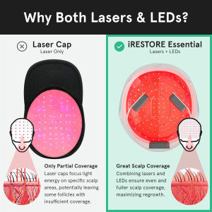iRestore Essential Laser Cap — FDA-cleared solution for hair growth, thinning & alopecia in men & women!