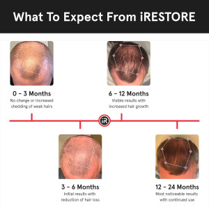 iRestore Essential Laser Cap — FDA-cleared solution for hair growth, thinning & alopecia in men & women!