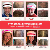 iRestore Essential Laser Cap - FDA Cleared Hair Growth Laser Therapy