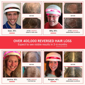 iRestore Essential Laser Cap — FDA-cleared solution for hair growth, thinning & alopecia in men & women!