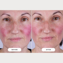 CurrentBody Skin LED Light Therapy Mask Series 2 – Advanced Skincare Tech