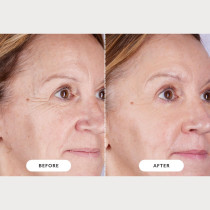 CurrentBody Skin LED Light Therapy Mask Series 2 – Advanced Skincare Tech