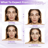 Red Light Therapy Mask for Face: Acne, Wrinkles & Skin Rejuvenation