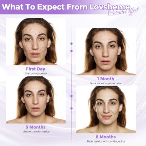 Red Light Therapy Mask for Face: Acne, Wrinkles & Skin Rejuvenation