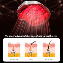 LED Hair Growth Cap - Laser Therapy for Men & Women Regrowth