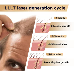 FDA Cleared Red Light Therapy Device for Hair Growth & Regrowth