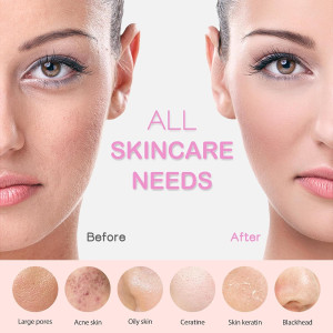 PRITECH Rechargeable Silicone Facial Cleansing Brush with Heat Massage