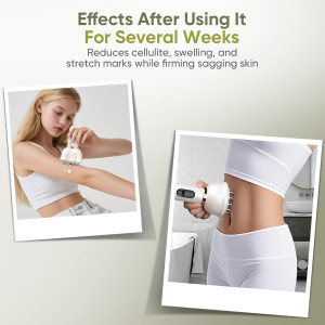 Body Sculpting Machine: Lymphatic Drainage & Anti-Cellulite Massager