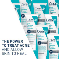 CeraVe Acne Foaming Cleanser 4% Benzoyl Peroxide | Gentle Daily Face Wash
