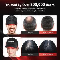 CAYAMA Red Light Therapy Hair Cap – 510 LEDs for Fuller Hair