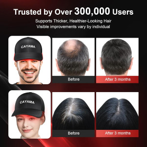 CAYAMA Red Light Therapy Hair Cap – 510 LEDs for Fuller Hair