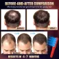 Peigne Laser de Croissance des Cheveux Rouge - Traitement pour Hommes et Femmes (1 pièce)