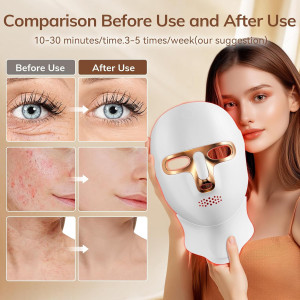 Cordless Red Light Therapy Mask for Face | USB-C Rechargeable LED Mask