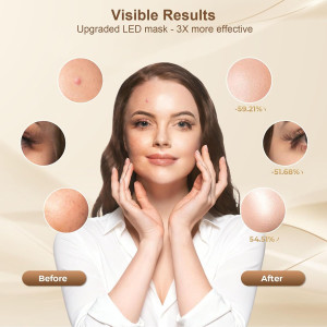 Rechargeable Red Light Therapy LED Face Mask for Comfortable Home Use