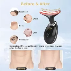 Appareil de Beauté Visage Multifonction avec Vibration et LED 7 Couleurs pour Soins à Domicile