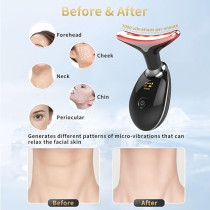 Multifunctional Facial Beauty Device with LED Light & Vibration for Skin