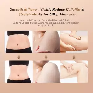 Massageur Cellulite 3-en-1 35 Vitesses - Drainage Lymphatique