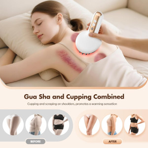Smart Lymphatic & Cupping Massager with Heat & Vibration for Cellulite
