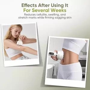 REDLOOK Body Sculpting Machine – Anti-Cellulite & Lymphatic Drainage Tool