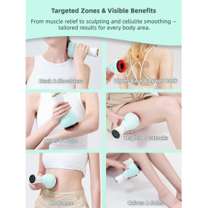 Electric Cupping Kit with Heat for Pain Relief & Body Sculpting Therapy