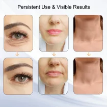 Appareil de massage visage & cou portable avec LED 7 couleurs