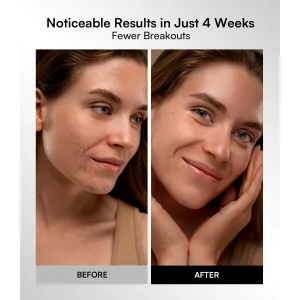 INIA Red Light Therapy Mask – 4 Modes, 850nm NIR & LED for Radiant Skin