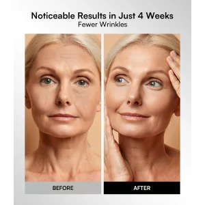 Masque LED INIA : 4 Modes Lumière Rouge 850nm NIR, Rechargeable