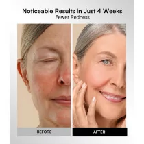 INIA Red Light Therapy Mask – 4 Modes, 850nm NIR & LED for Radiant Skin