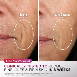 Shark CryoGlow LED Face Mask with Cooling, Anti-Ageing & Repair - Lilac