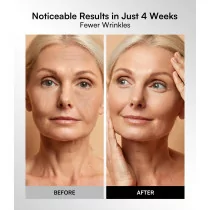 Red Light Therapy Mask for Face & Neck – 4 LED Modes for Skin Glow