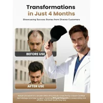 Advanced Laser Hair Growth Cap | Red Light Therapy for Thicker Hair