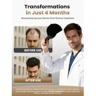 Advanced Laser Hair Growth Cap | Red Light Therapy for Thicker Hair